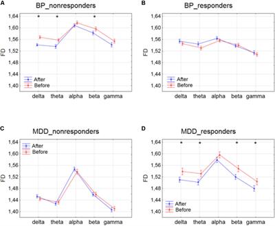 Complexity Analysis of EEG Data in Persons With Depression Subjected to Transcranial Magnetic Stimulation